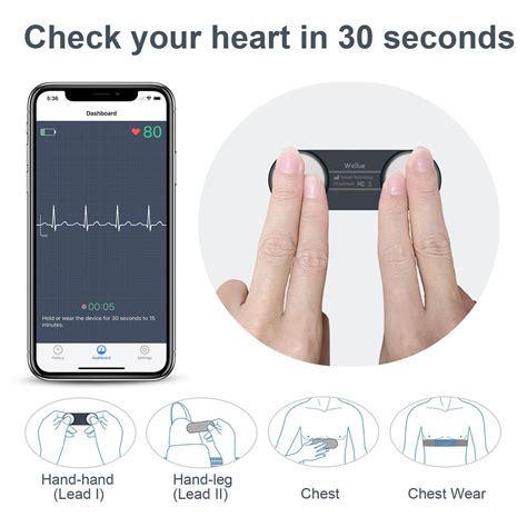 Mobile EKG & Echocardiogram – RapidX Mobile Diagnostic Services