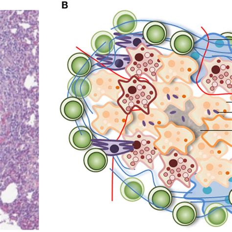 Modeling the Mycobacterium tuberculosis Granuloma – the Critical ...