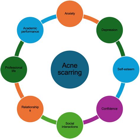 Moderate acne scars.  By combining microneedling with radiofrequency energy, thi...