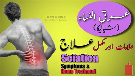 Mohammad Almabadi on LinkedIn: Sciatica pain (عرق النسا) is a ...