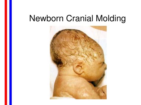 Molding newborn. .  <a href=http://insi.protarget.pro/f4fut/real-flight-simulator-laptop.htm...