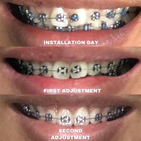 Monello462 Onlyfans Leak XxX 💋