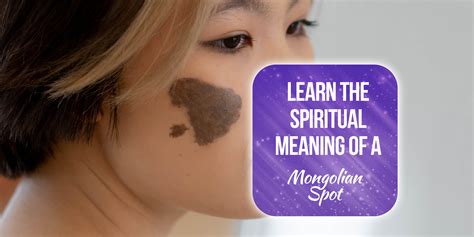 Nov 3, 2022 · The Mongolian spot birthmark has a long history of being seen as a symbol of miscarriage. There are, however, deeper spiritual truths and implications associated with Mongolian spot spiritual meaning. The Mongolian birthmark, also known as a Mongolian spot, is a pigmentary skin disorder that is disproportionately prevalent among people of East ... . 