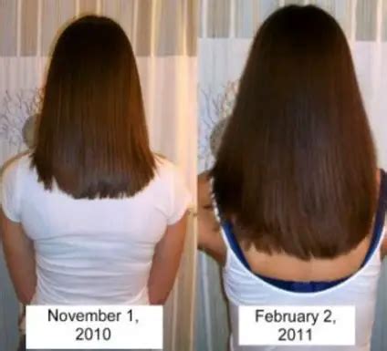 Biotin hair growth before and after pictures. HairTru™ vitami