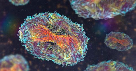 Monkeypox Claims First US Victim