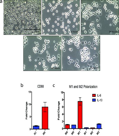 Monocyte to macrophage differentiation and polarization. SC monocytes