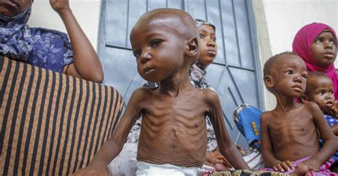 More people can’t afford nutritious food and 148 million children are stunted by hunger, UN says