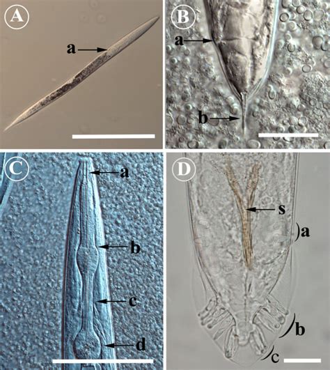 Morphology of Pelodera strongyloides from SEM. A) Two Pelodera... Download Scientific Diagram