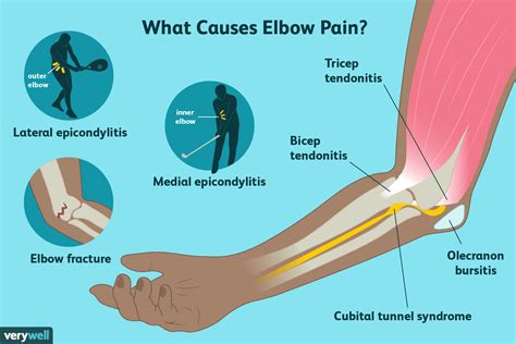 Most Common Elbow Injuries: Symptoms, Causes & Treatment