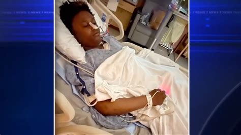 Mother of 15-year-old injured in Hollywood shooting speaks out; medical condition likely saved teen’s life