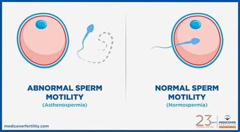 Motil sperm nedir