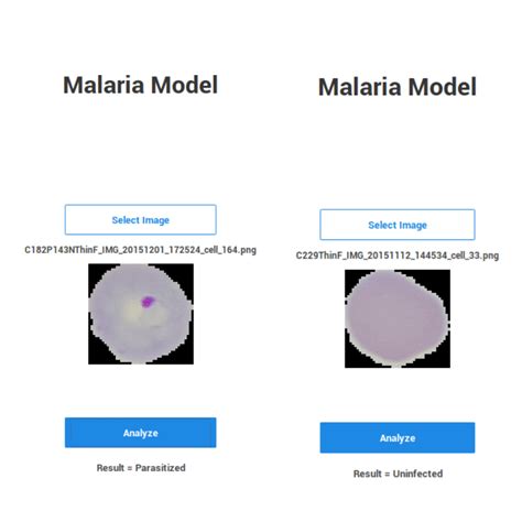 Motion detection deep learning github.  Dataset: NIH Malaria Cell Images Dataset...