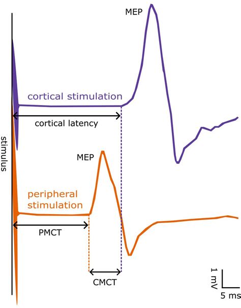 Motor Evoked Potential MEP Testing How and Why It s Done