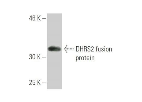 Mouse Anti-DHRS2 Recombinant Antibody (1F10) from Creative …