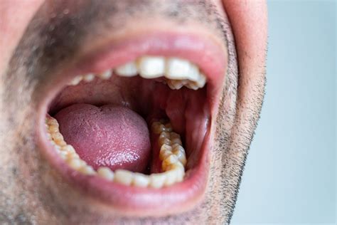 Mouth Fuck Onlyfans Leak