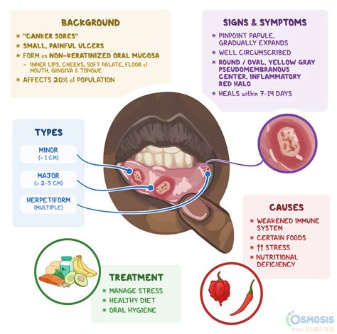 Mouth Sores: Common Causes, Symptoms, & Treatment K Health