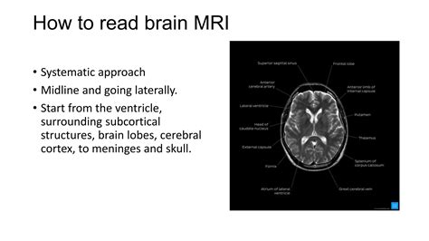 Mri sequences ppt. edu/htbooks/mri/inside.  This document provides an ...
