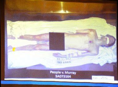 Dr Conrad Murray is serving four years for Jackson's manslaughter. Dr Christopher Rogers, the medical examiner who performed the autopsy, noted the 50-year-old star's scalp had been tattooed black .... 