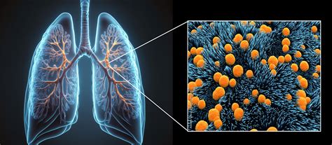 Mucoviscidose uitleg