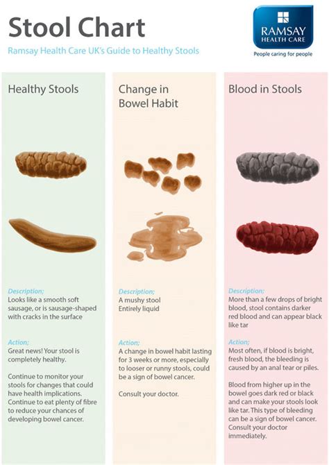 Possible Causes of Mucus in the Stool. Ther