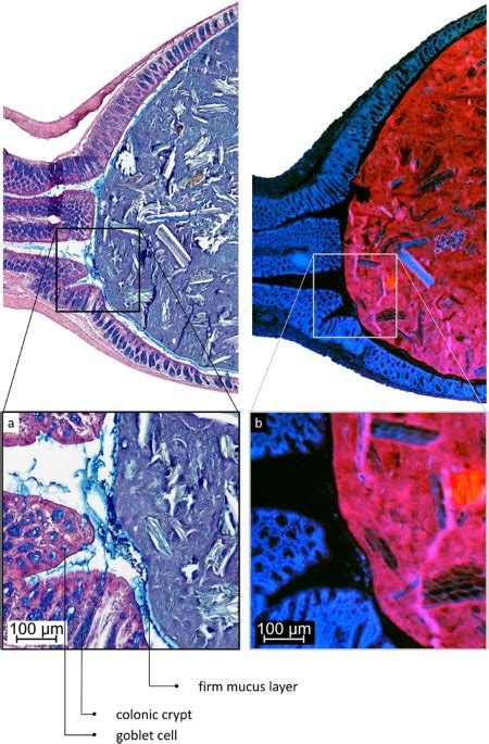 Mucus organisation is shaped by colonic content; a new view