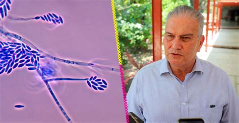 Muere en México primer paciente por infección de hongo Fusarium solani