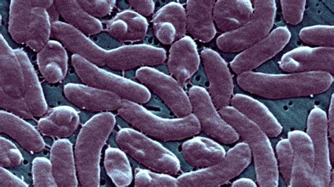Mueren tres personas por una infección con una rara bacteria carnívora en Connecticut y Nueva York
