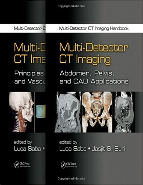 Multi detector ct imaging handbook two volume set by crc press 2013 11 05. - Passkey ea review complete individuals businesses and representation irs enrolled agent exam study guide.