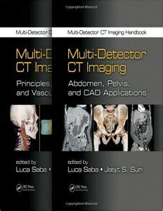 Multi detector ct imaging handbook two volume set. - 2003 mitsubishi eclipse manual transmission fluid change.