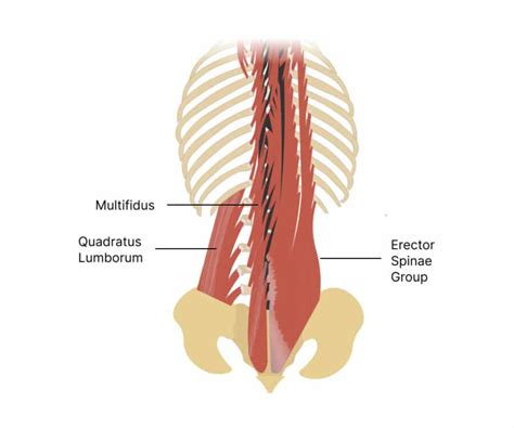 Multifidus Muscle: An Important Spinal Stabilizer.