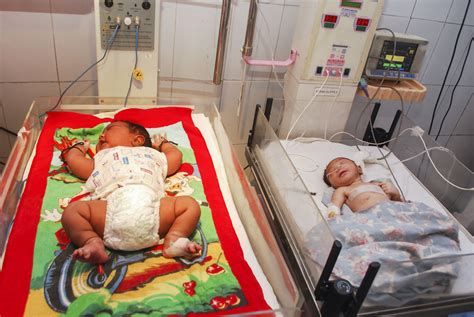 Mum gives birth to ‘heaviest baby’ in India, weighing 15lb