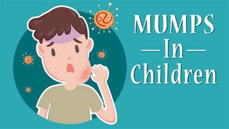 Mumps in Children - Nationwide Children