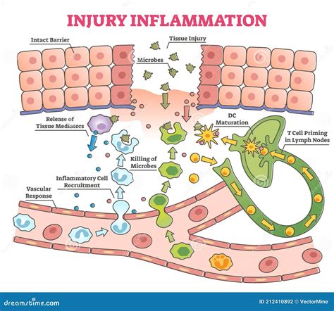 Muscle Injury , Inflammation & repair - SlideShare