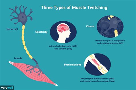 Muscle twitching for hours. .  ...