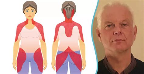 Muskelreumatism alkohol