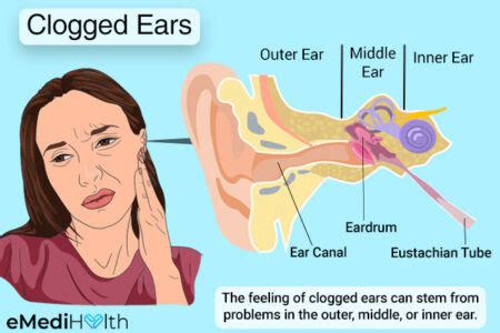 My ear is clogged up now for a month, what to do? - HealthTap