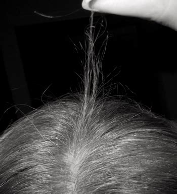 My hair is breaking off at the top. May 13, 2012 ... The presence of broken hairs can be due to many causes, including excessive hair damage (heat damage, chemical processing, use of straightners). 