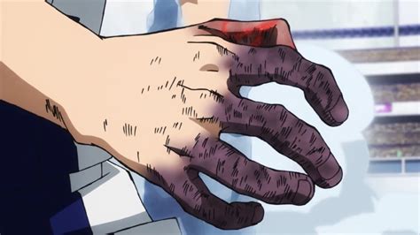 My hero academia hands. Healing Hands is a quirk that allows the user to heal anyone they touch. The more grevius the wound the longer the user has to keep their hands on the person they are healing. While they are using their powers the healer is unable to move. Can heal fatal wounds and the user can heal themselves. They even can grow back limbs. The user is completely … 