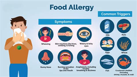 My physician guide to food allergies by timothy shybird. - Orden y desorden a escala mundial.