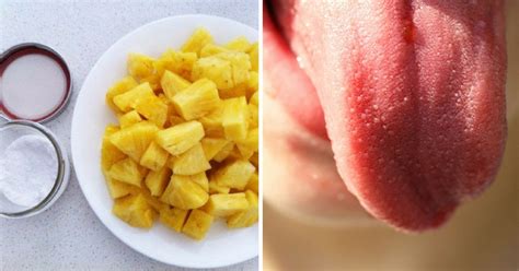 My tongue started to bleed, after eating fresh pineapple. I…