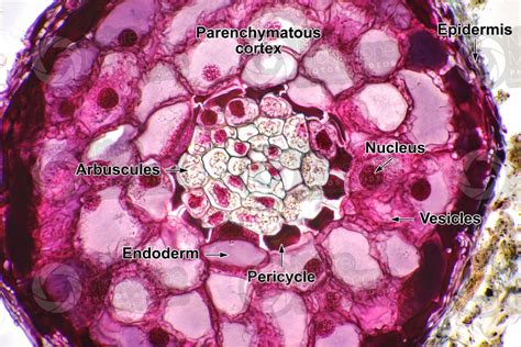 Mycorrhizae under microscope labeled. Things To Know About Mycorrhizae under microscope labeled. 