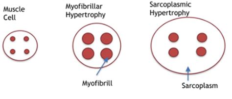 Myocyte cellular hypertrophy is responsi…