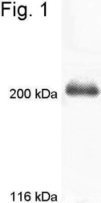 Myosin VIIa Antibody (NB120-3481): Novus Biologicals