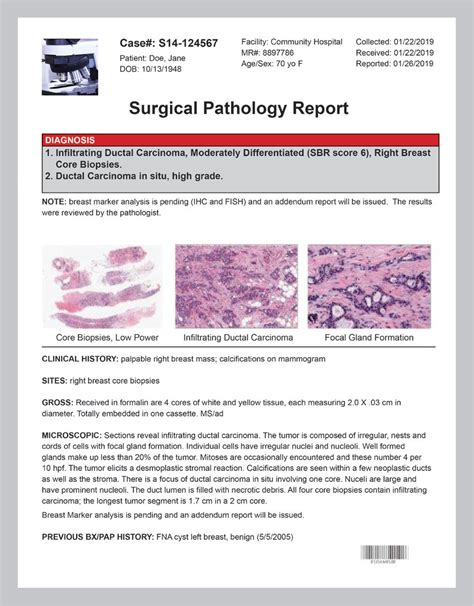 This is the doctor who analyzes the sample of tissue removed during a biopsy to make the correct diagnosis. . Mypathologyreports