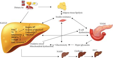 NAFLD, Insulin Resistance, and Diabetes Mellitus Type 2 - Hindawi