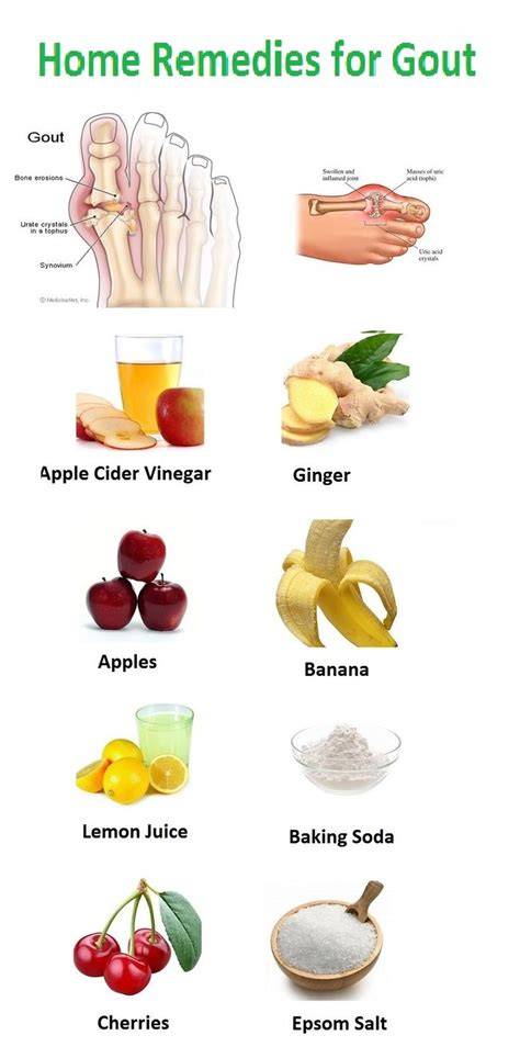 Natural Gout Treatment Support - Best Uric Acid … - raincitystudios.com