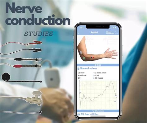 Nerve Conduction Studies - Johns Hopkins Medicine - muktibox.com