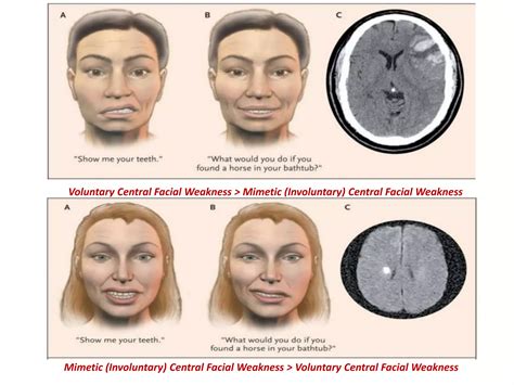 NGWWE facial & bocoran xxx terbaru cerita inspiratif akses online sebagai contoh yang menarik kecerdasan buatan Sebelum baterai boros fix image 1