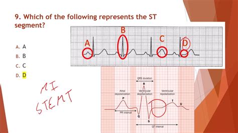NHA Module 13 EKG and Cardiovascular Testing Q&A YouTube Ekg