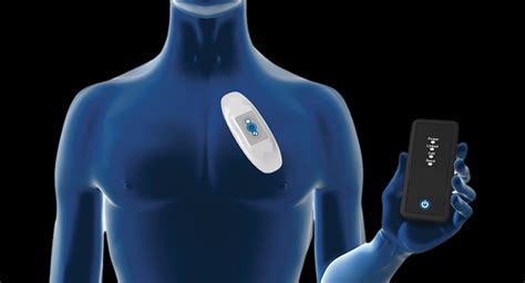 Novel Wireless Devices for Cardiac Monitoring - coolestguyplanet.net
